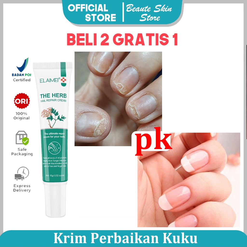 ELAIMEI Krim Perbaikan Kuku 15g Lembut Krim Kuku Shu Krim Perbaikan Kuku Tanaman Cerah Perawatan Kuku Kuku Onikomi Cream