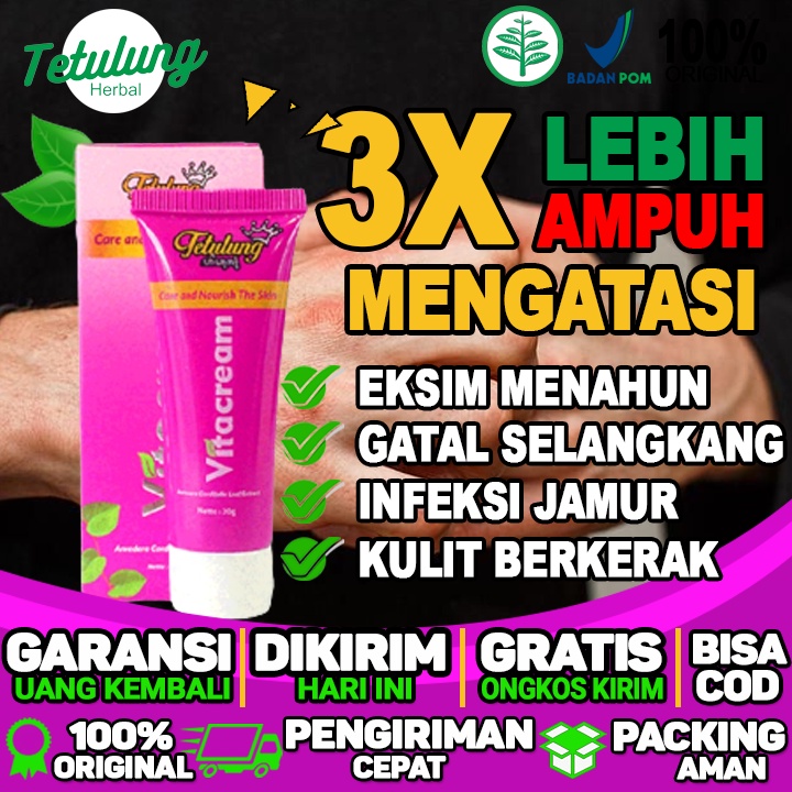 Salep Untuk Gatal Pada Kemaluan Pria/wanita Salep Untuk Pusar Gatal Dan Berair