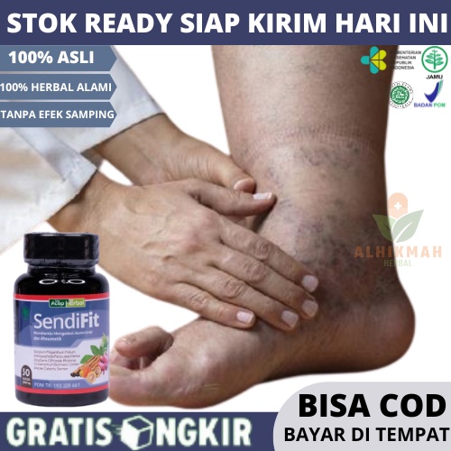 Obat Kaki Bengkak Asam Urat, Obat Kaki Bengkak, Obat Penyakit Kaki Gajah, Obat Pengempis Kaki Bengka