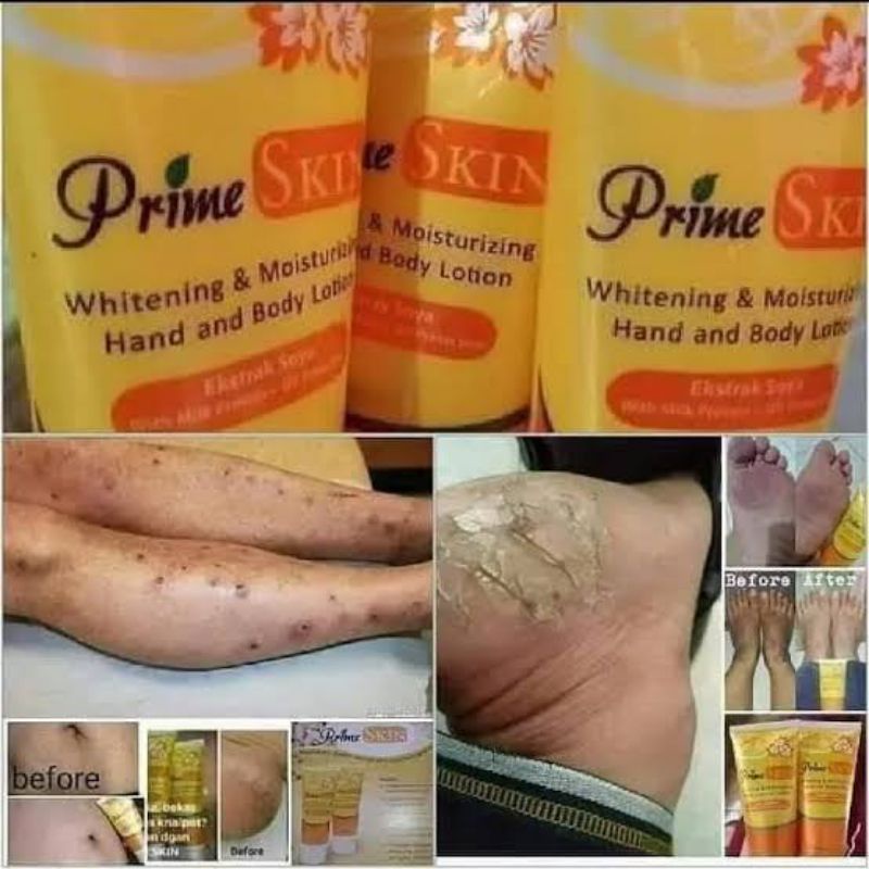 Prime Skin Hand Body Lotion HWI 100% Original