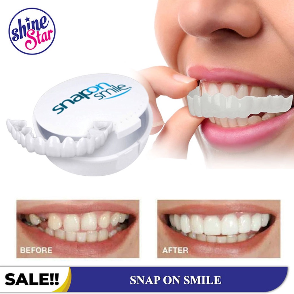 [ COD ] ORIGINAL 100% SNAP ON SMILE AUTHENTIC / GIGI PALSU SEPASANG ATAS BAWAH