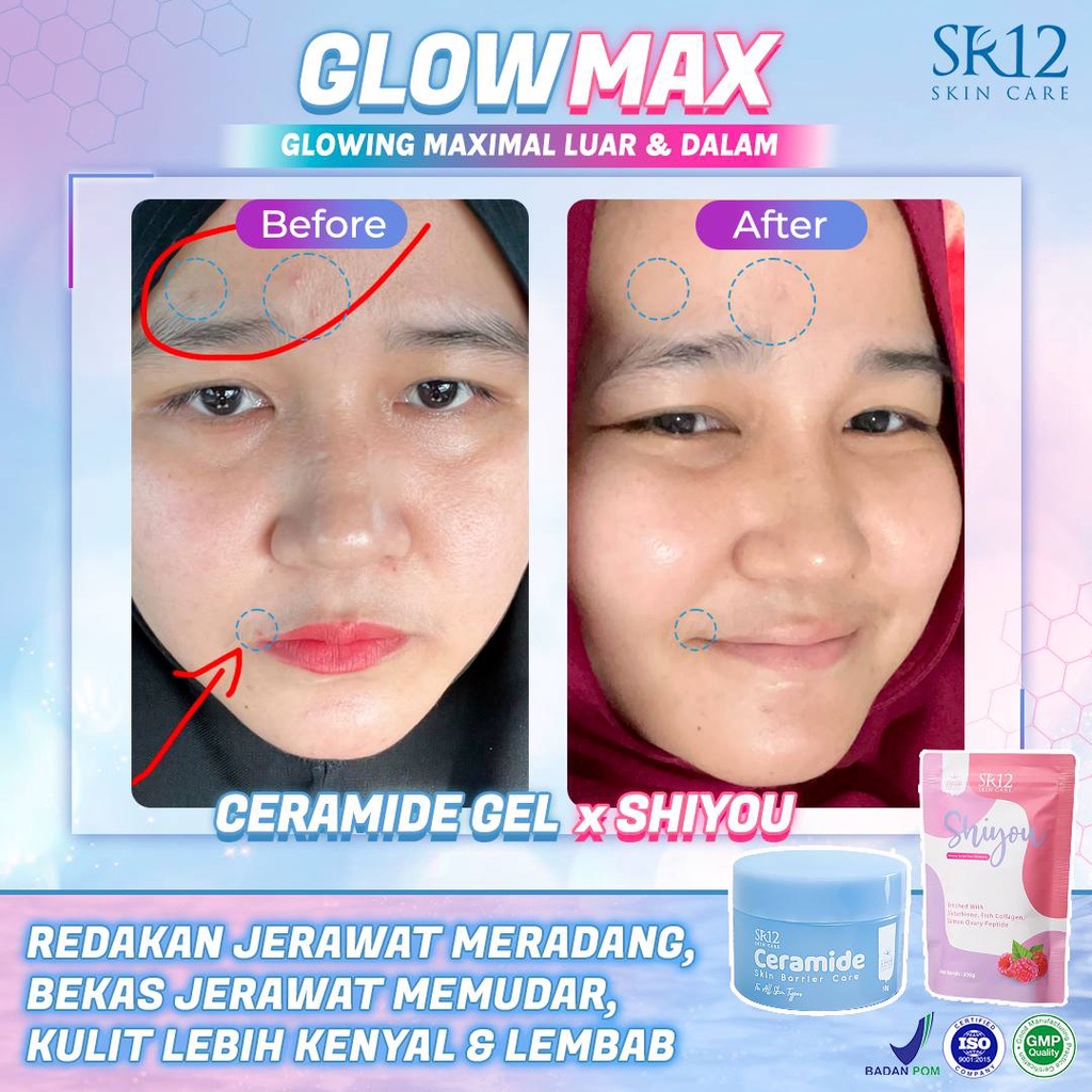 Shiyou SR12 Minuman Collagen Pemutih Badan BPOM Mencegah Kulit Keriput Menyehatkan Saluran Pencernaan