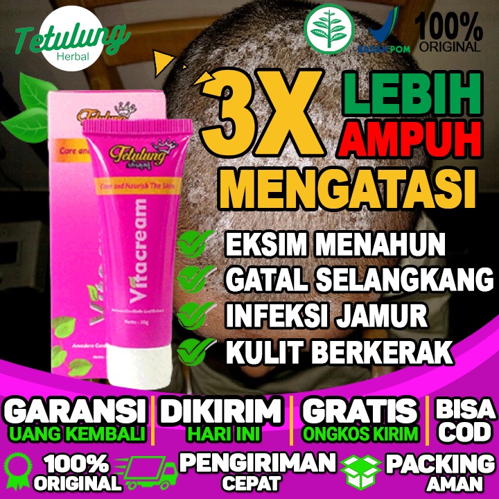 Salep Untuk Gatal Merah Di Kulit Salep Untuk Gatal Merah Di Wajah Gatal di area kepala