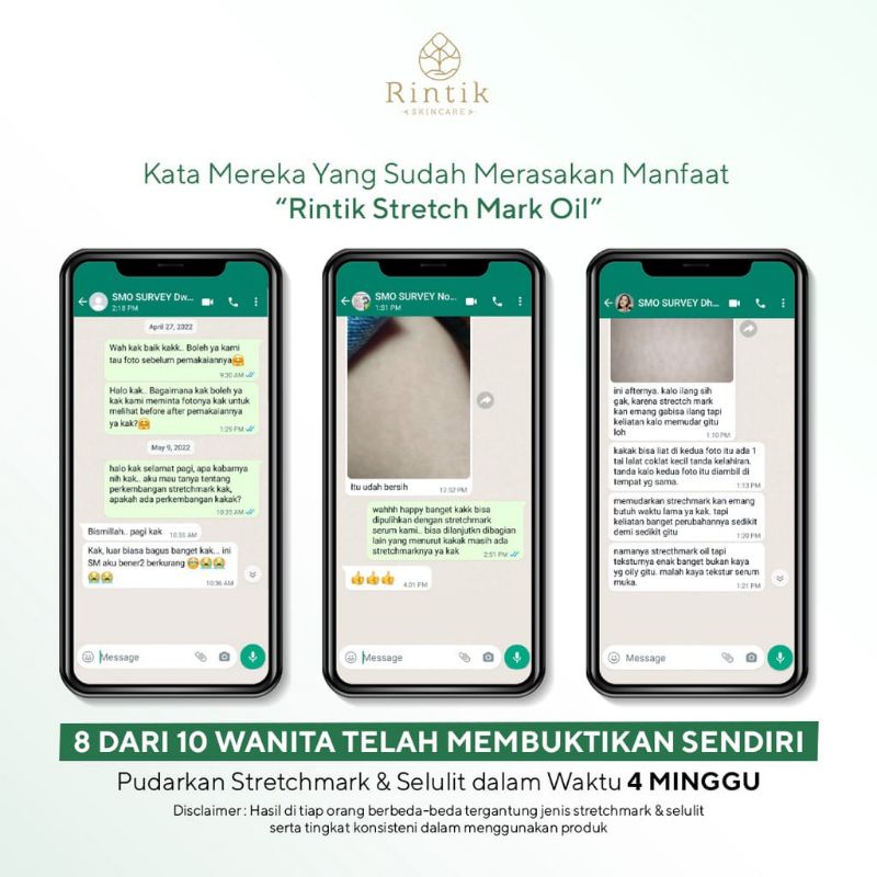 Rintik Skincare - Stretch Mark Selulit Oil / Stretch Mark Selulit Oil By Rintik Skincare Penghilang/Pemudar Stretch Mark / Penghilang Stretchmark Ampuh Permanen Bpom / Cream minyak Serum Pengilang Stretchmark