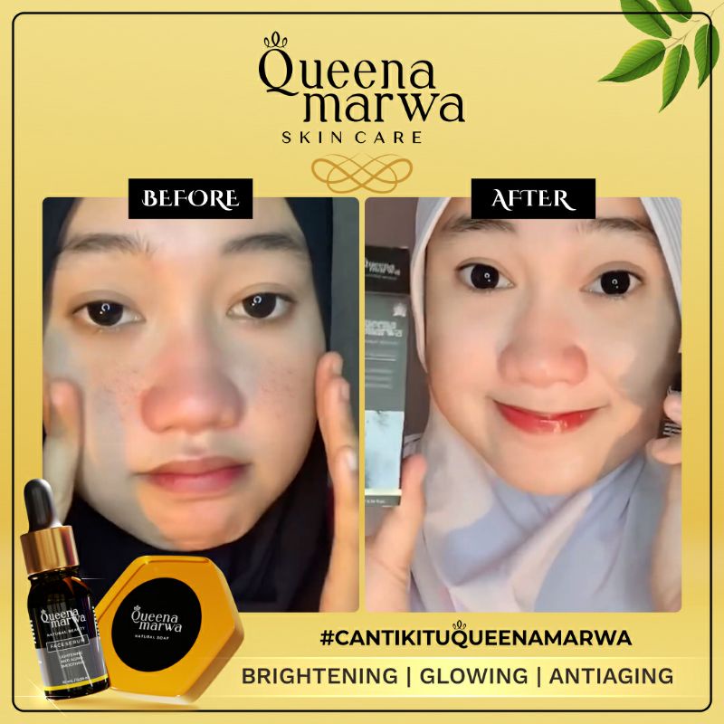 Queena Marwa Natural Soap Original Sabun Wajah Aman BPOM 80 gr