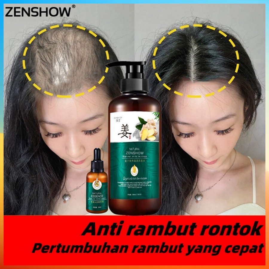 ZHENXIU shampo rambut rontok 500ml Meningkatkan Pertumbuhan Rambut Rambut Tebal Mengontrol Minyak Anti Ketombe