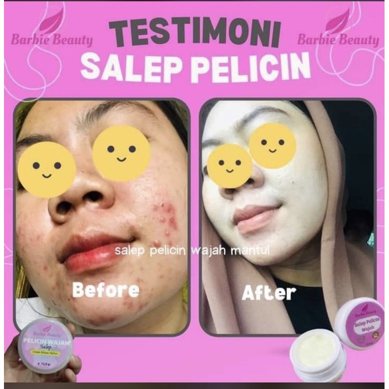 [ cek PHOTO sudah bpom aman ] hati2 barang kw murah // barbie beauty ada harga grosir ❤️ salep pelicin berbie beauty || new produk pasti best seller - berbie beauty salep pelicin wajah khusus malam - salep glowing berbie beauty night cream