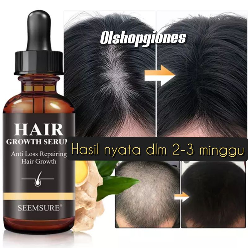 SEEMSURE GROWTH SERUM penumbuh rambut botak anti rontok aminexil original