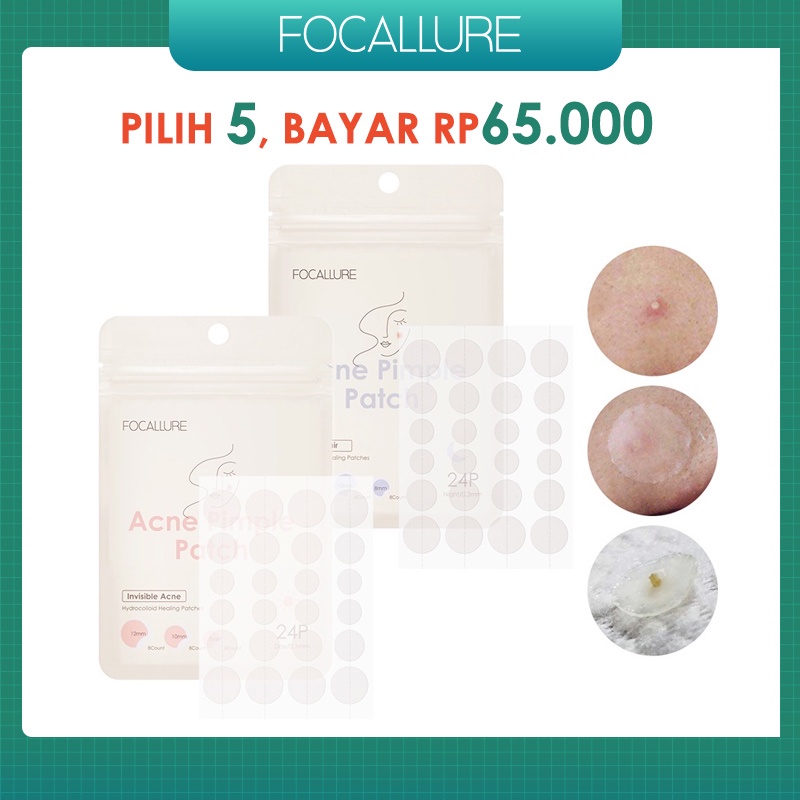 FOCALLURE Spot Patch Acne Treatment Day/Night Long-lasting Acne Nose&amp;Face Patch Mask FA186