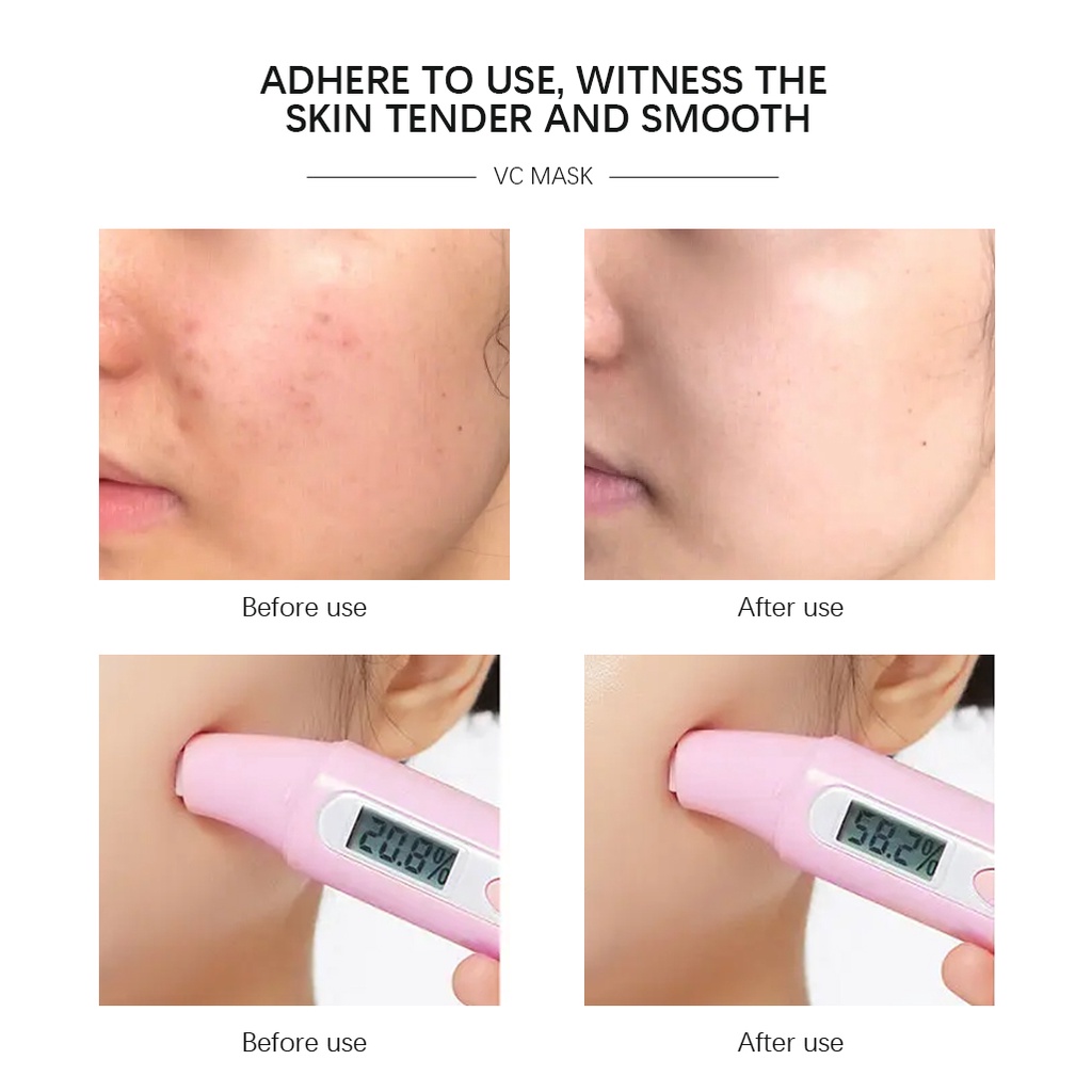 【asli】Allphv Sheet Masker Wajah Retinol/Hyaluronic Acid/Vitamin C/Rose Wajah Serum  Essence Mask Whitening Moisturizing SKIN CARE MASK MASKER SHEET Collagen Soothing Pemutih Pelembab Acne Removal Anti Aging Kerut  Masker Wajah 1pcs