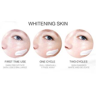 【COD】Whitening Freckle Cream acne cream Remove Dark Spots Anti Freckle Cream  Fade Pigmentation Melasma Brighten Creams Penghapusan Jerawat