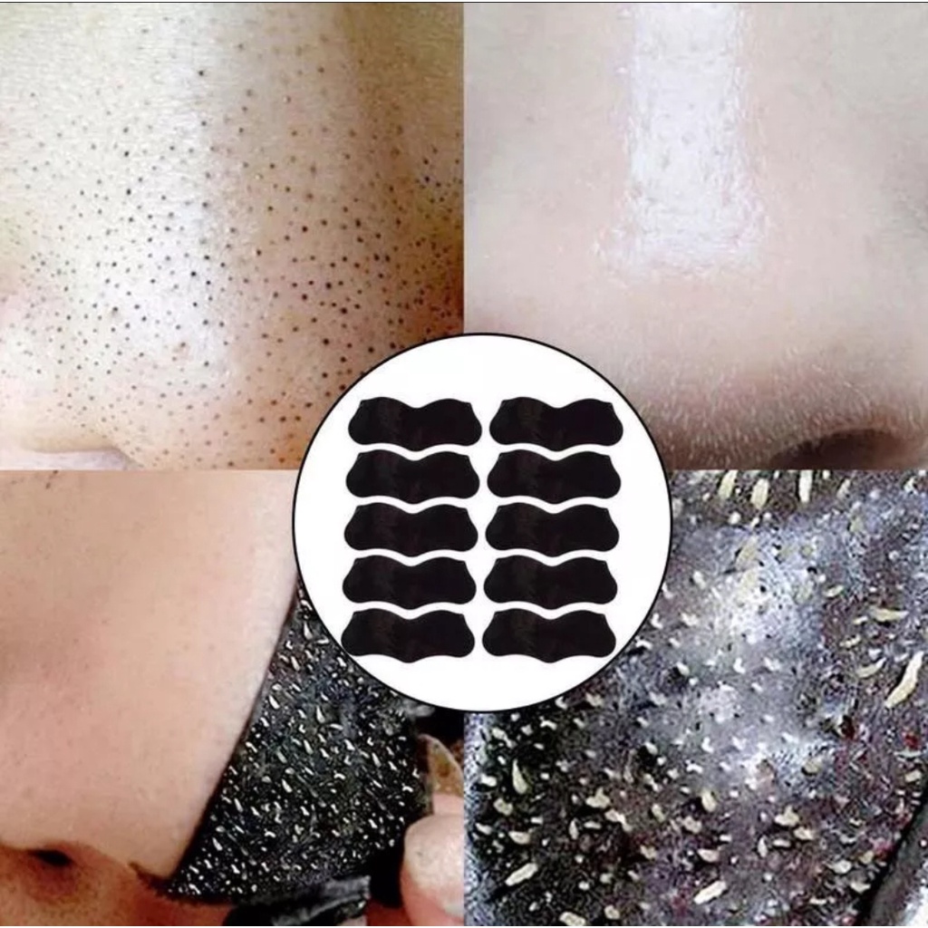 IMPORT 10 STRIP PENGHILANG KOMEDO HIDUNG MASKER KOMEDO STIKER KOMEDO HIDUNG PORI-PORI PEMBERSIHAN ME