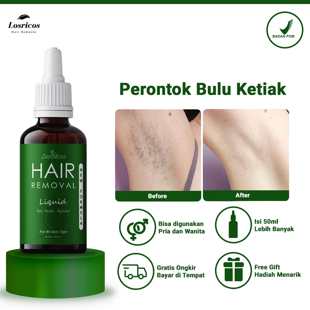 Jual Perontok Bulu Ketiak Permanen, Penghilang Bulu Rambut Ketek Aman ...