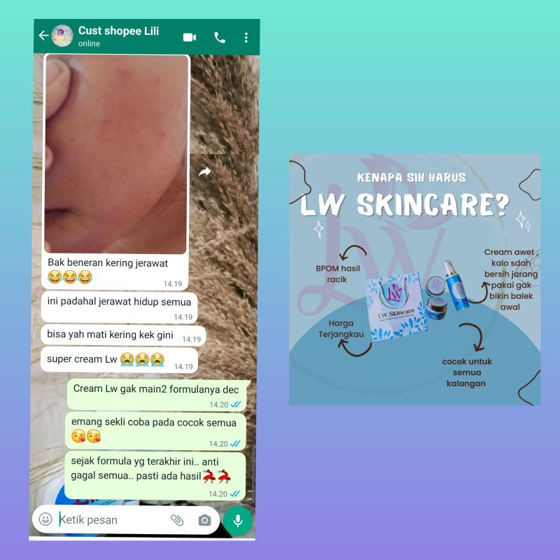 LW SKINCARE ACNE PAKET BASIC