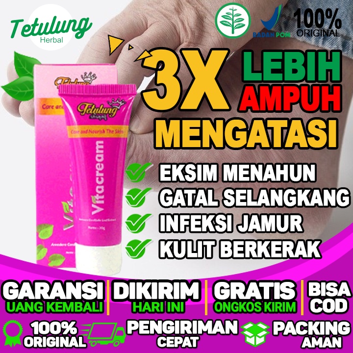 Salep Gatal Jamur Di Bokong Salep Gatal Jari Tangan Salep Gatal Jamur Di Kaki Dan Eksim Menahun