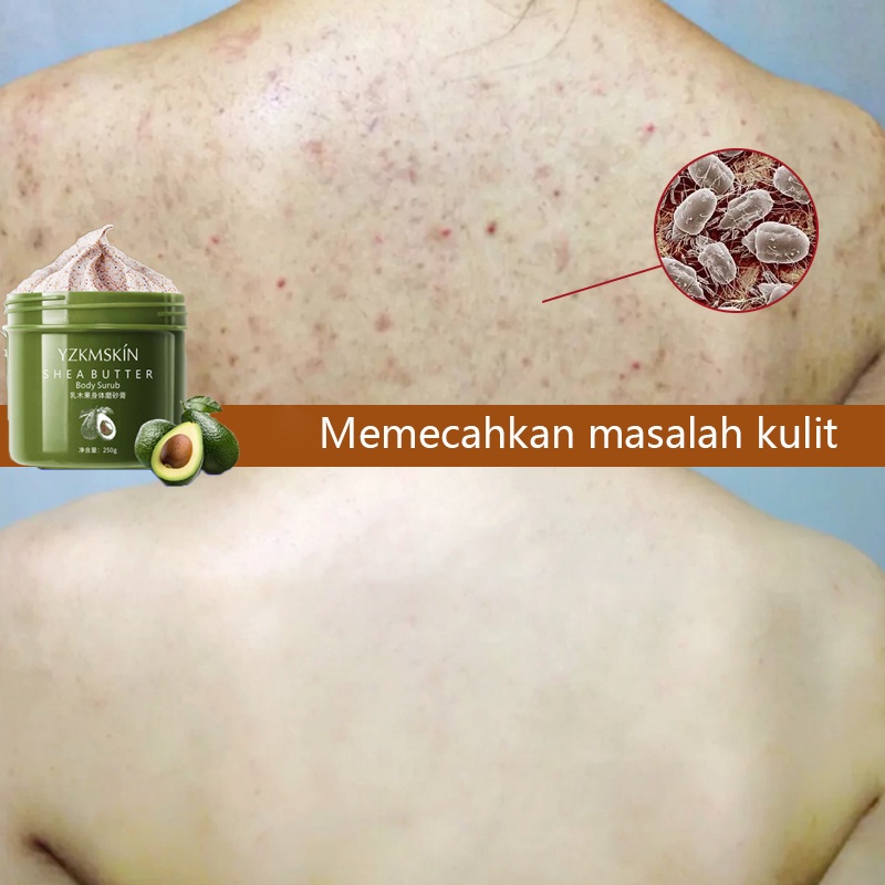 Scrub Cream Scrub Butt 250g Scrub Body&amp;Butt Eksfoliasi Scrub Pemutih Scrub Niacinamide Mengeksfoliasi Dan Meremajakan Kulit Mencerahkan Kulit Mengurangi Kusam