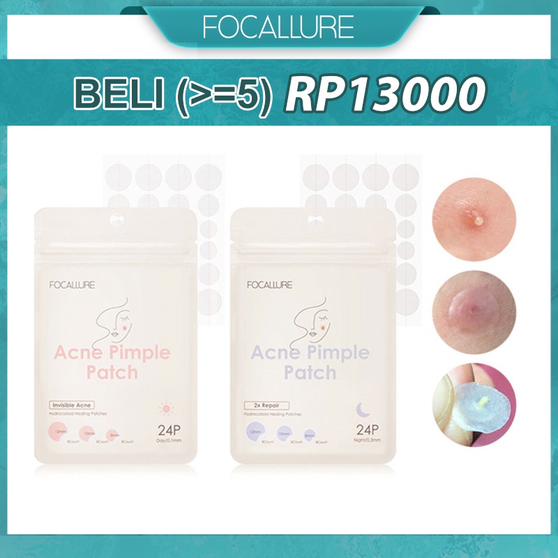 FOCALLURE Spot Patch Acne Treatment Day &amp; Night Acne Repair Patch Skin Care Long-lasting Pengobatan Jerawat fa186