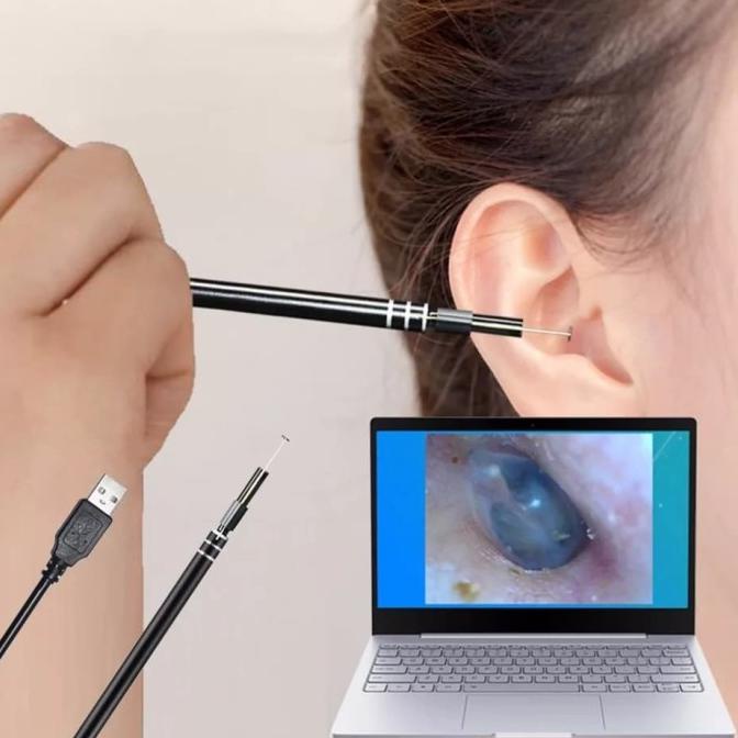 Alat pembersih / telinga kamera pembersih telinga dan hidung mulut