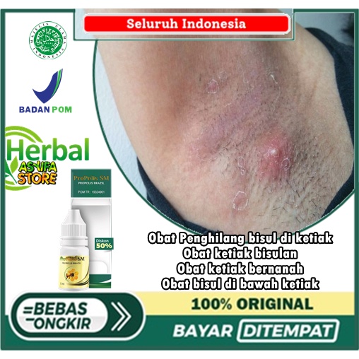 Obat Penghilang bisul di ketiak, Obat ketiak bisulan, Obat ketiak bernanah, Obat bisul di bawah keti