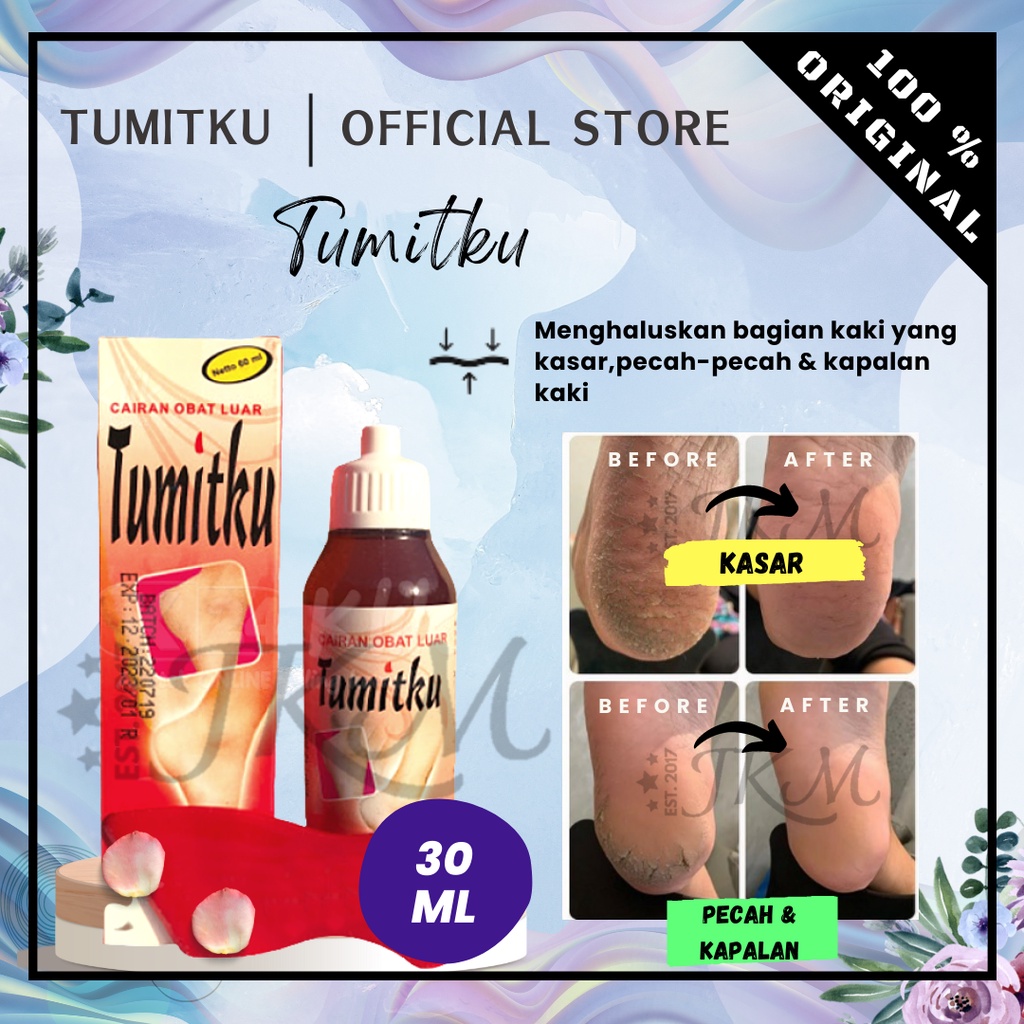 TUMITKU BPOM TUMITKU MENGATASI KAKI PECAH KAPALAN DENGAN CEPAT CAIRAN OBAT LUAR TUMITKU