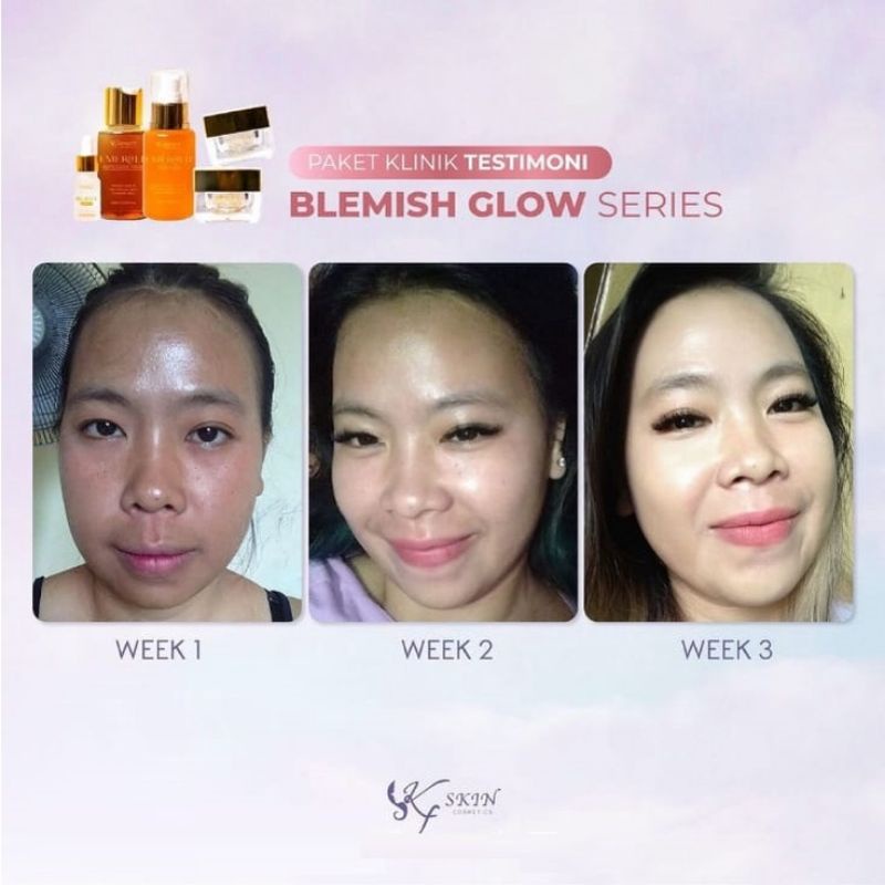 KF SKIN KLINIK BEAUTY TAHAP 1 BLEMISH GLOW KEMASAN BARU