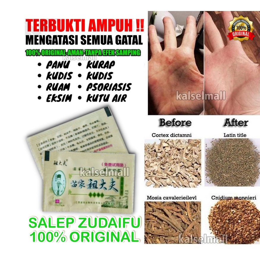 SALEP KRIM GATAL OBAT SALAP 100% ORIGINAL ZUDAIFU UNTUK SEMUA GATAL GATALAN SACHET ALERGI KULIT JAMURAN JERAWAT EKSIM PSOARISIS KUDIS PANU KURAP PANUAN SKABIES HERBAL EKSIM JAMUR KUTU AIR KEPUTIHAN SELANGKANGAN HERPES OBAT CINA ZHUDAIFU AMPUH ZUDAIPU OC2