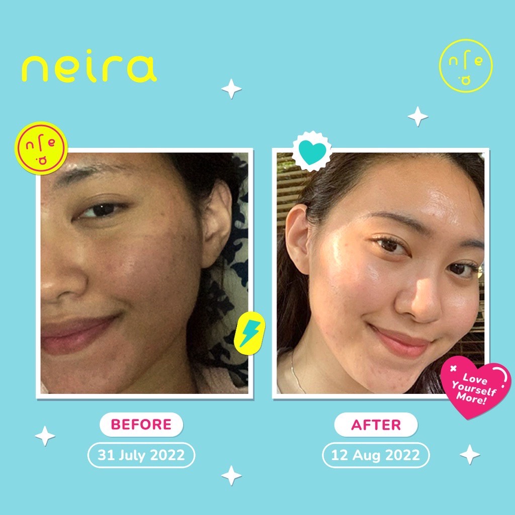 NEIRA Superfood Skin Juice Glow Booster / Acne Hack / All Time Glow Exfoliator Toner
