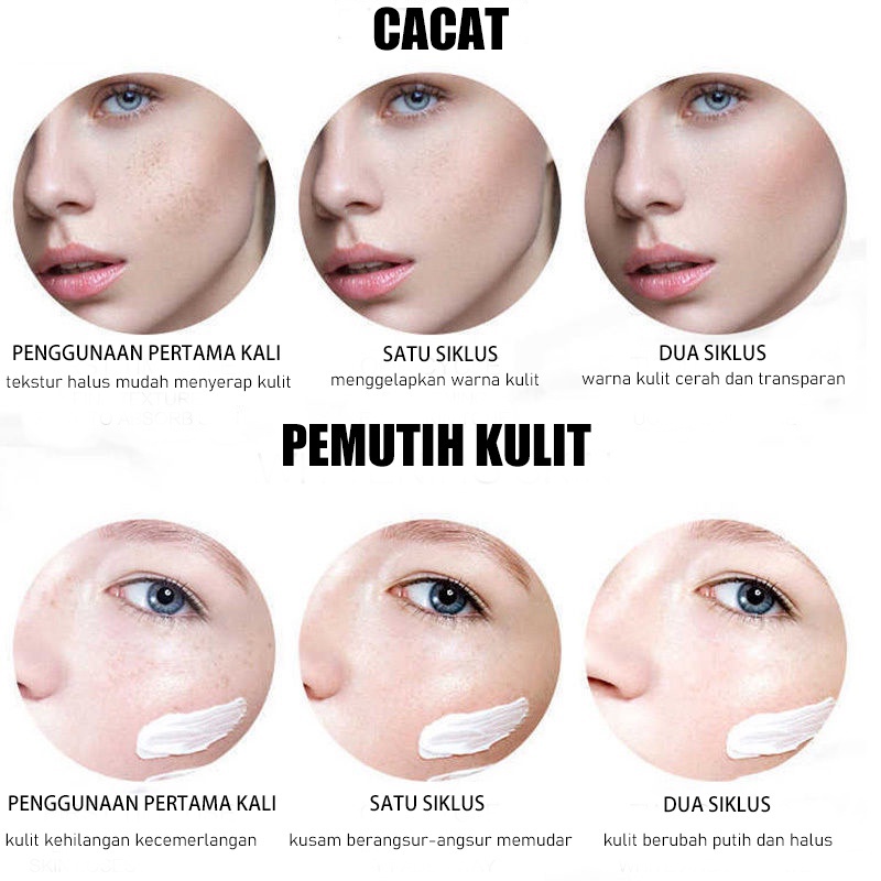 krim Serum cream Flek Hitam Cream Penghilang Cream flek Penghilang 20g Pemutih Asli Dan Penghilang Bintik Memudarkan Bintik Menghilangkan flek Cream penghilang