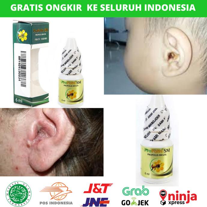 

Discount Obat Tetes Telinga Gendang Telinga Robek, Pecah, Berair PROPOLIS SM /OBAT TELINGA BERDENGUNG/OBAT TELINGA BERAIR/OBAT TELINGA TERSUMBAT/OBAT TELINGA BUDEG/OBAT TELINGA BERNANAH