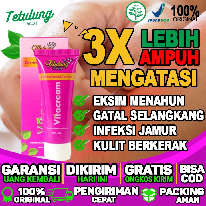 Salep Untuk Gatal Di Jari Kaki Salep Untuk Gatal Di Sela Jari Tangan Salep Untuk Kulit Gatal Karena 