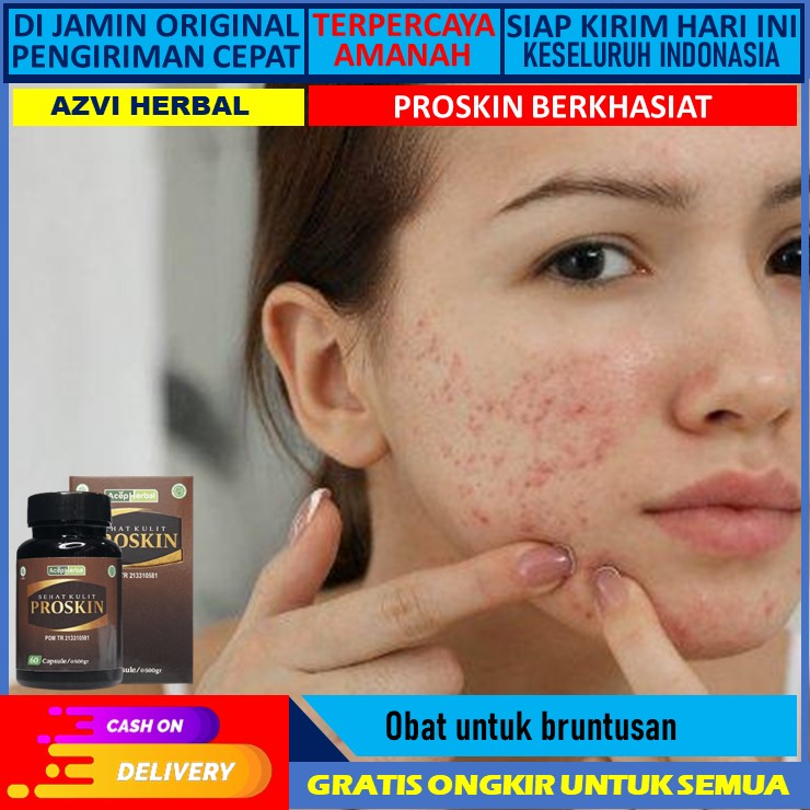 obat bruntusan  obat bruntusan wajah  obat bruntusan Obat Jerawat Dan Bekas Jerawat, Obat Jerawat Di
