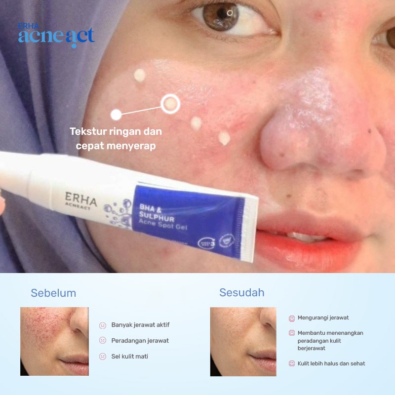 ERHA Paket Perawatan Jerawat Pungung dan Wajah - Acne Back Spray + Acne Spot Gel