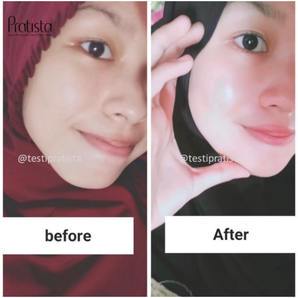 Calming Spray Pratista Membantu Merawat Wajah yang Berjerawat &amp; Bekasnya