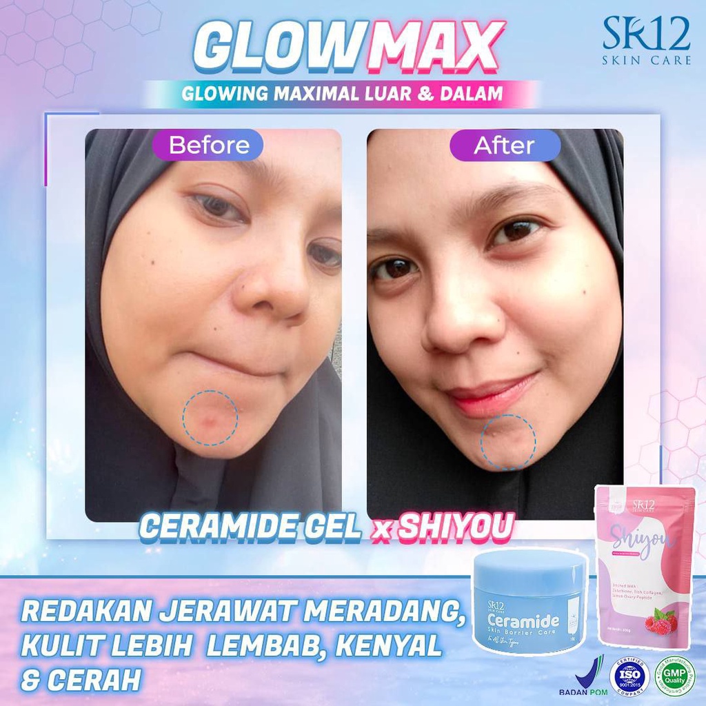 SR12 Ceramide Skin Barrier Care 18gr Pelembab Wajah Melembabkan Mencerahkan Kulit Muka BPOM