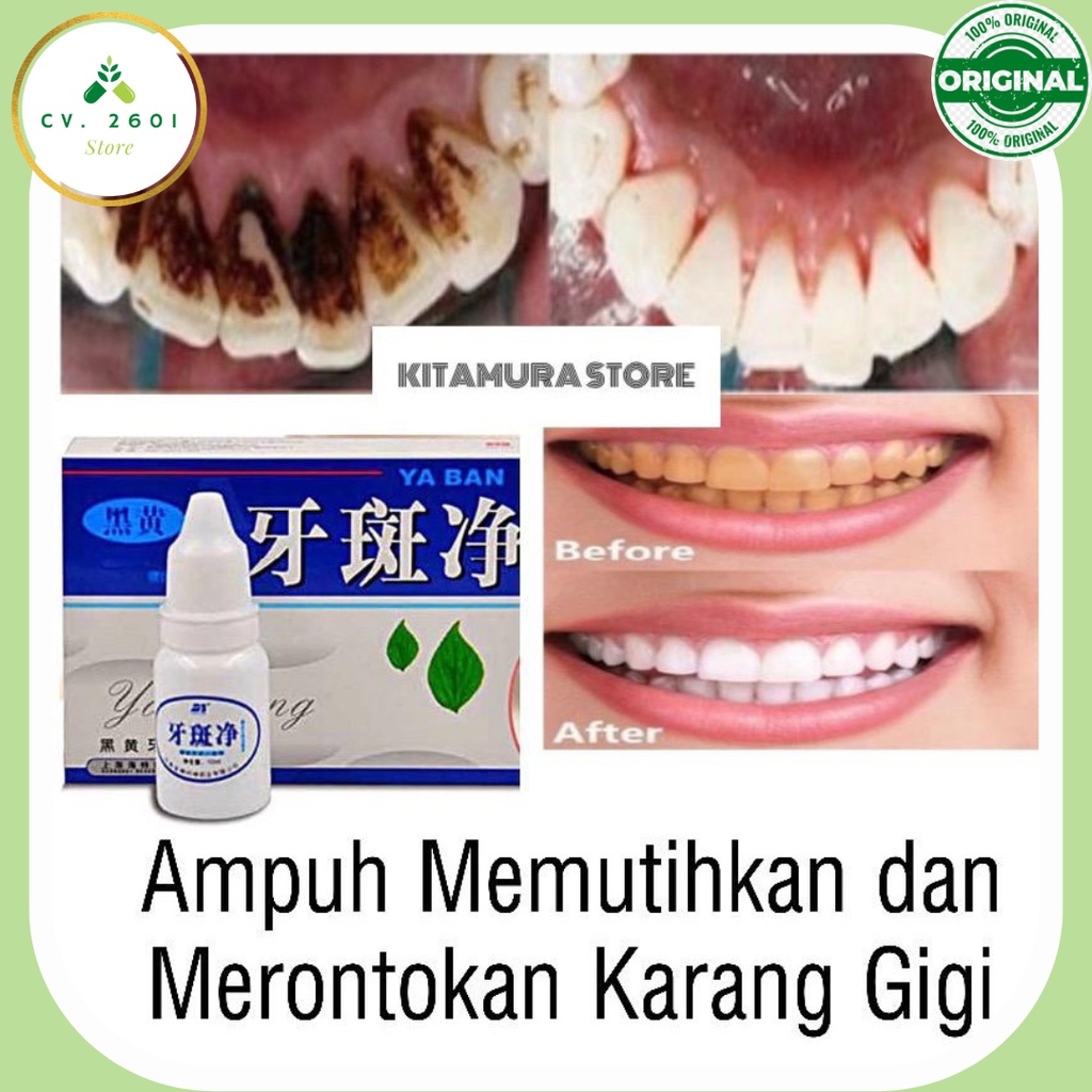 YABANJING PEMUTIH GIGI PENGHILANG PLAK KARANG GIGI MEMUTIHKAN GIGI PERMANEN