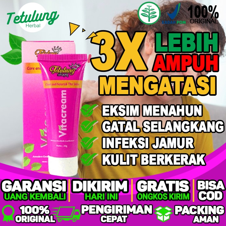 Salep Buat Gatal Eksim Salep Kulit Gatal Eksim Kering Dan Eksim Menahun