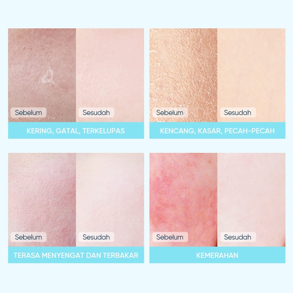 ❤ MEMEY ❤ SKINTIFIC 5X Ceramide Soothing &amp; Repairing Sheet Mask | Masker Wajah