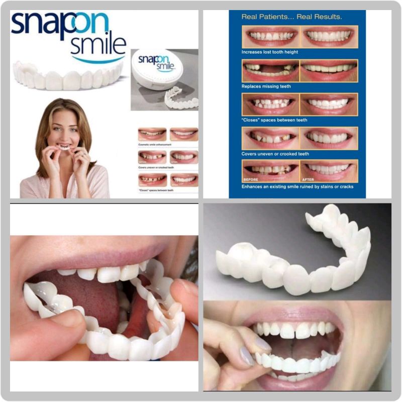 SNAP ON SMILE ORIGINAL 1 PASANG ATAS DAN BAWAH - VENEER GIGI PALSU