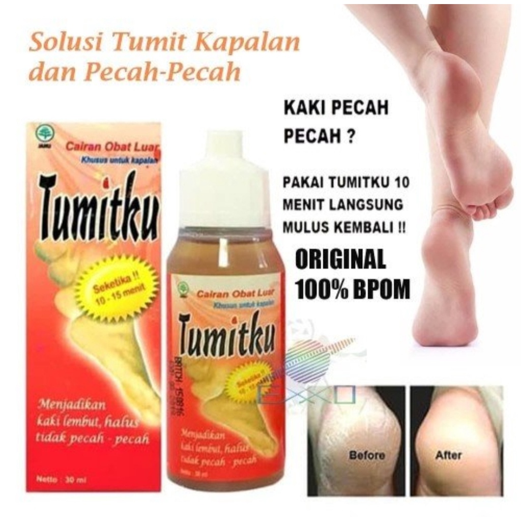 TUMITKU original Obat kaki pecah dan kering foot cream ampuh bpom original