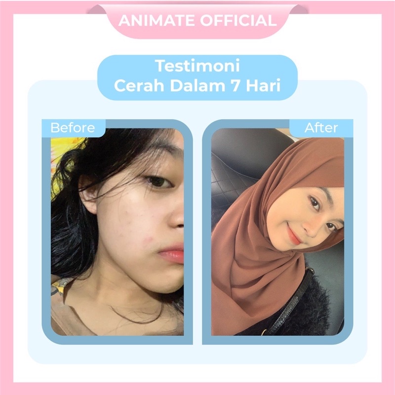 Animate Dark Spot + Whitening Serum 20ML / Menyamarkan Flek Hitam BPOM