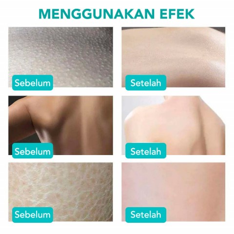 Thailand Natural Butt Whitening Cream 100g Mencegah Dan Melindungi Tubuh Jerawat Pemutih Tubuh