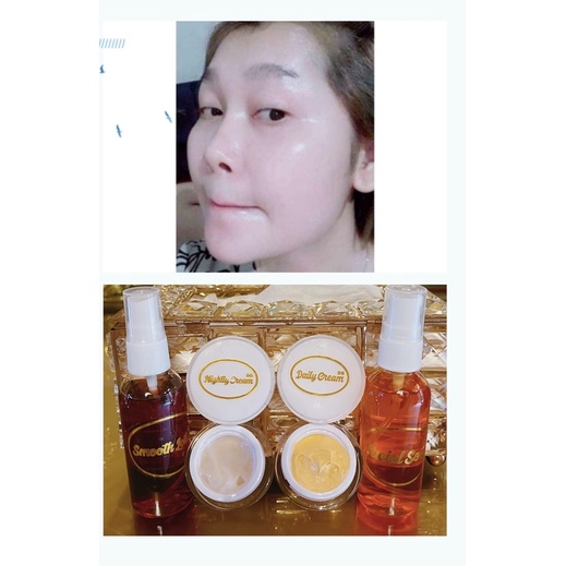 Paket Skincare Ds Whitening/Acne/Flek