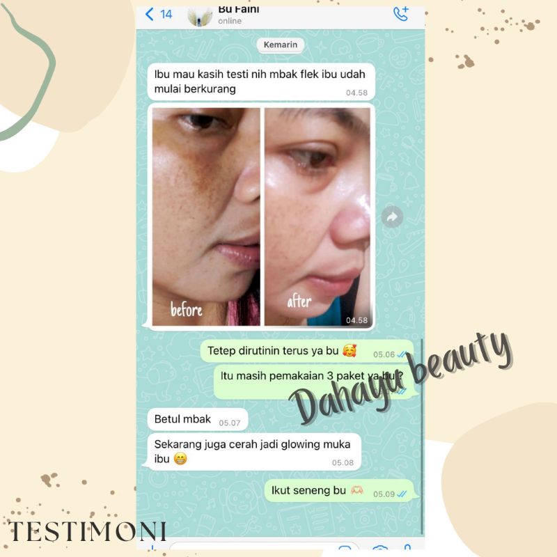 CREAM MALAM FLEK BOOSTER SUPER