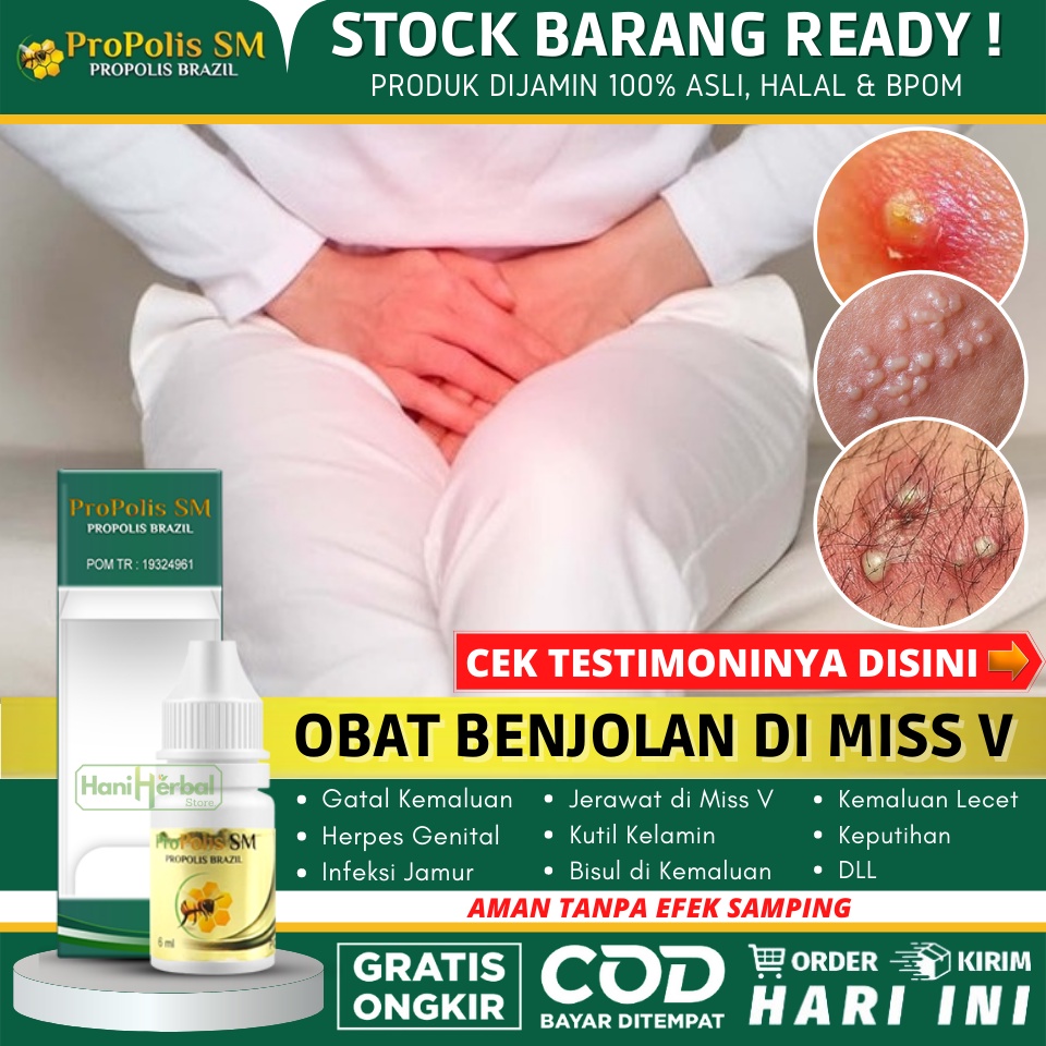 PROPOLIS SM - OBAT BENJOLAN DI MISS V - OBAT BENJOLAN DI BIBIR MISS V - BENJOLAN DI DALAM MISS V - B