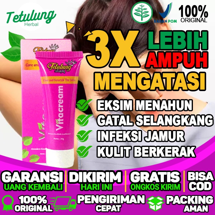 Salep Gatal Eksim Menahun Salep Gatal Eksim Untuk Ibu Hamil Salep Untuk Gatal Eksim Kering