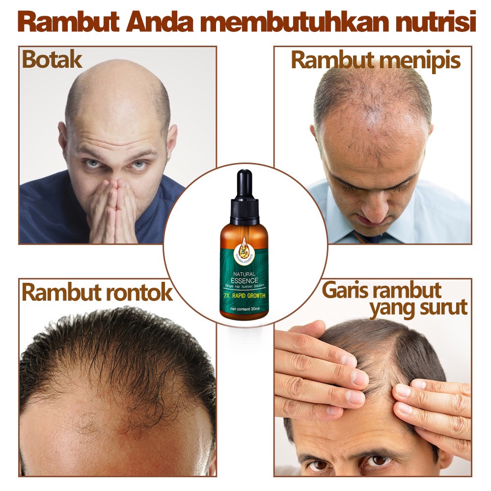 Anti rambut rontok Vitamin rambut Memperbaiki tekstur rambut/Vitamin jahe rambut Mengobati rambut rontok Perawatan kulit kepala Vitamin mempercepat penumbuhan rambut/Untuk perawatan rambut menipis dan serum memperbaiki folikel rambut