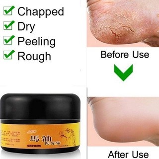 Obat Kaki Pecah Krim tangan dan kaki Kering Foot Cream Krim Herbal China 30g Kaki Kapalan Pecah Kering Cream Kaki Pecah Obat Tumit Pecah Tangan Kapalan Pecah Kasar Kering