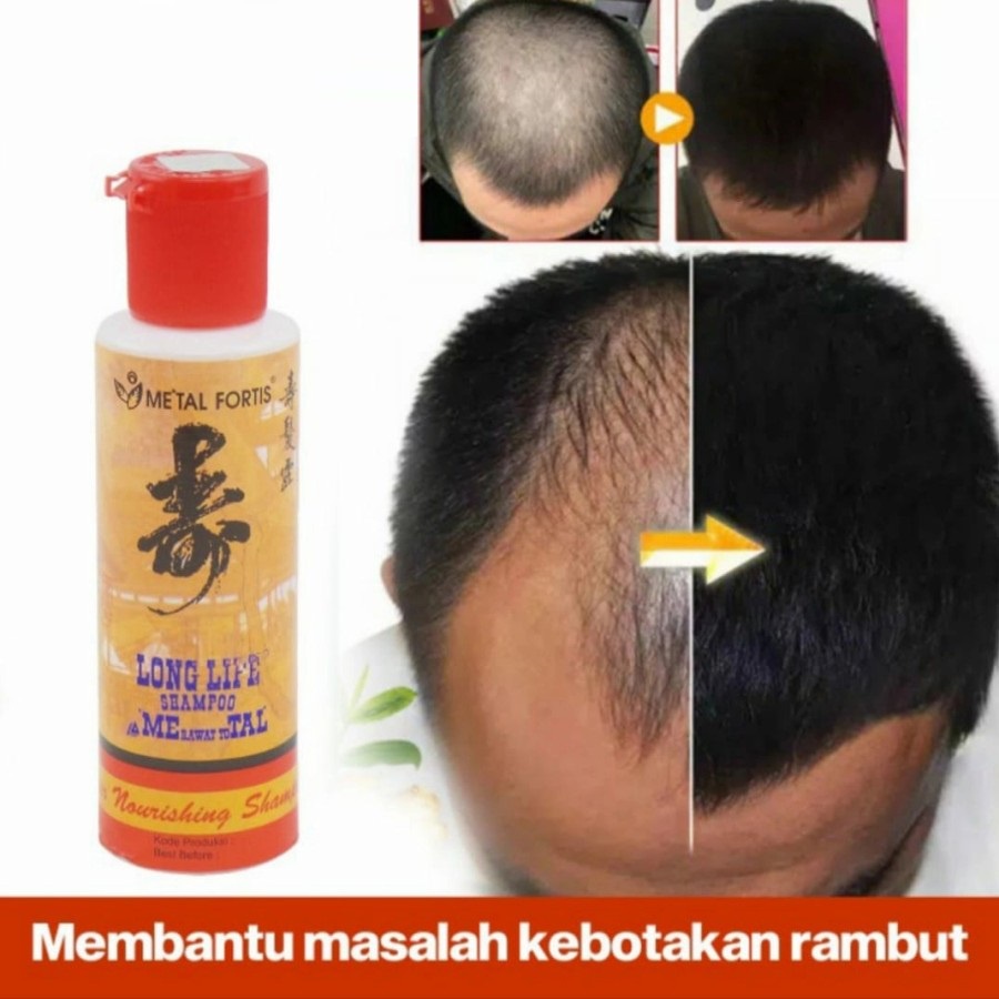 Sampo Metal Fortis Shampo Shampoo Metal Fortis Sampo Pemanjang Penumbuh Rambut Botak Rontok Pria Dan Wanita Cepat Ampuh Lebat Dan Tebal Original
