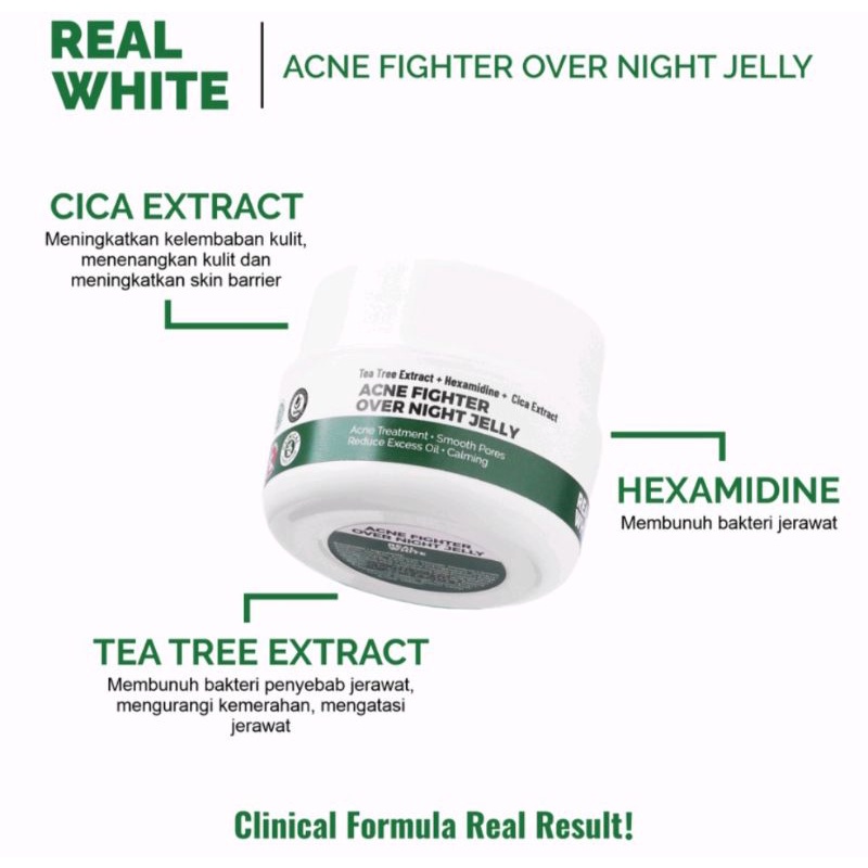 REAL WHITE Acne Fighter Over Night Jelly/Jerawat Meradang