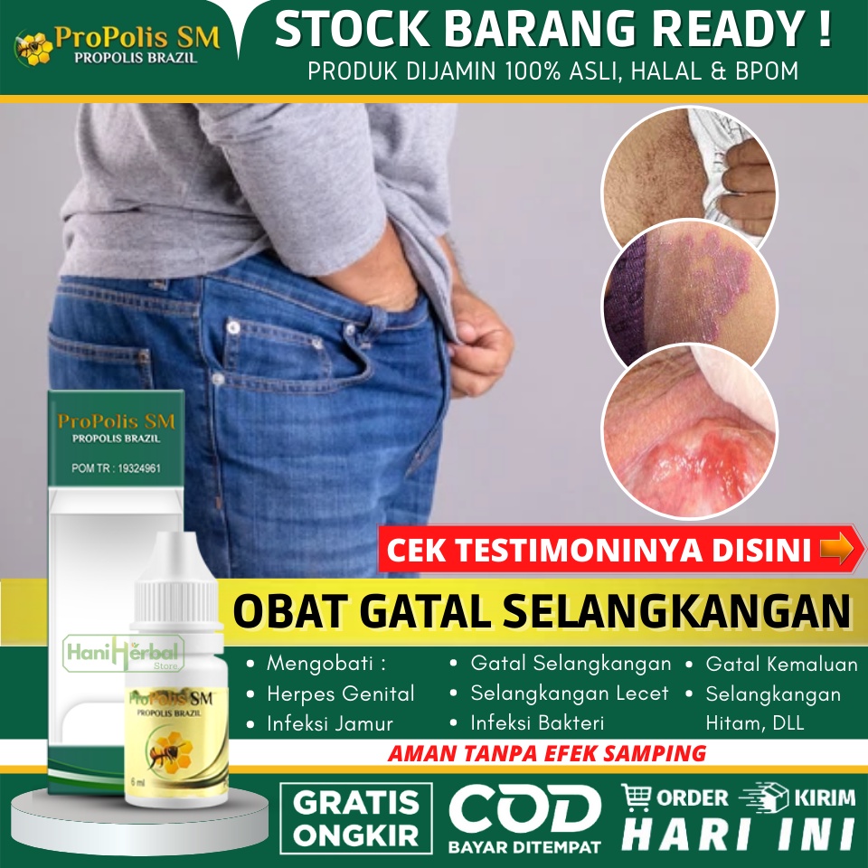 OBAT SELANGKANGAN GATAL & LECET, OBAT SELANGKANGAN BERJAMUR, PENGHILANG JAMUR DI SELANGKANGAN, SELAN